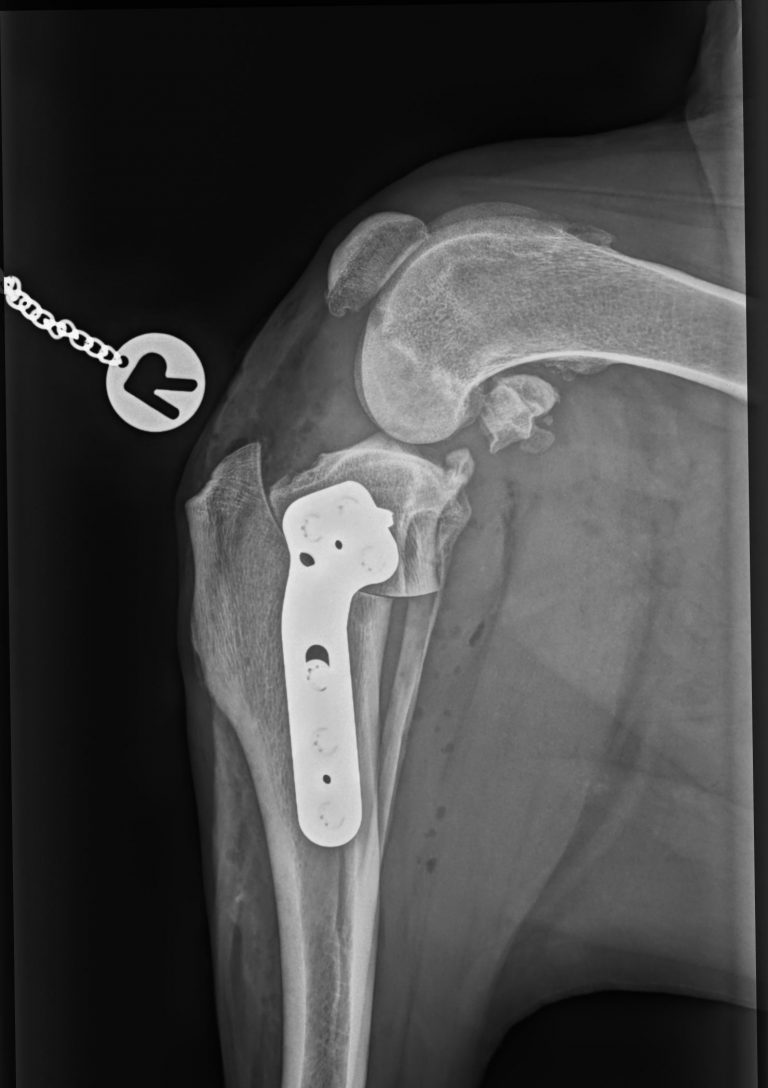 TPLO 3
